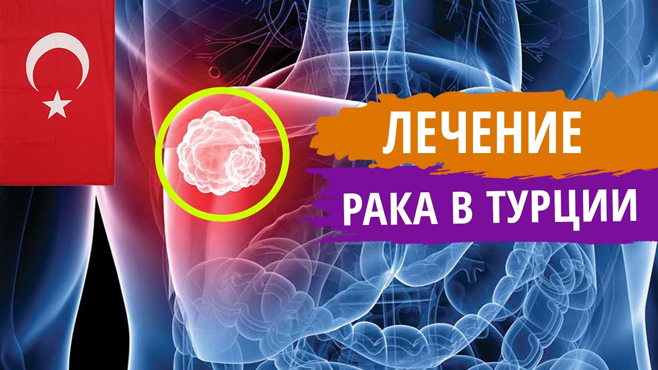 Лечение рака в Турции. Медицинский туризм в Стамбуле | Переезд в Турцию на ПМЖ | Серия #10