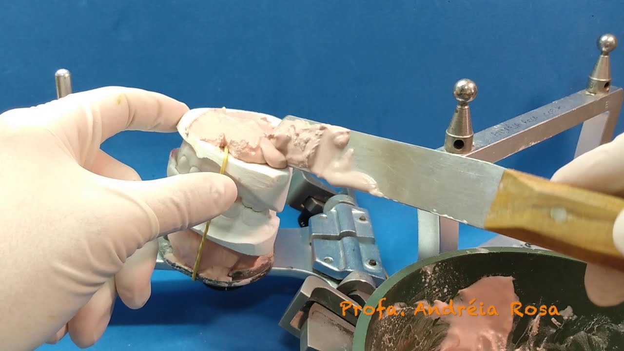 Montagem dos modelos no ASA para o enceramento