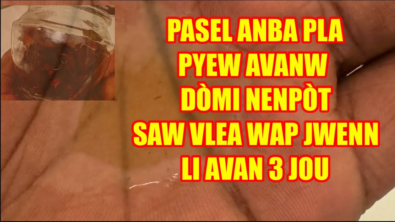 PASEL ANBA PLA PYEW AVANW DÒMI NENPÒT SAW VLEA WAP JWENN LI AVAN 3 JOU