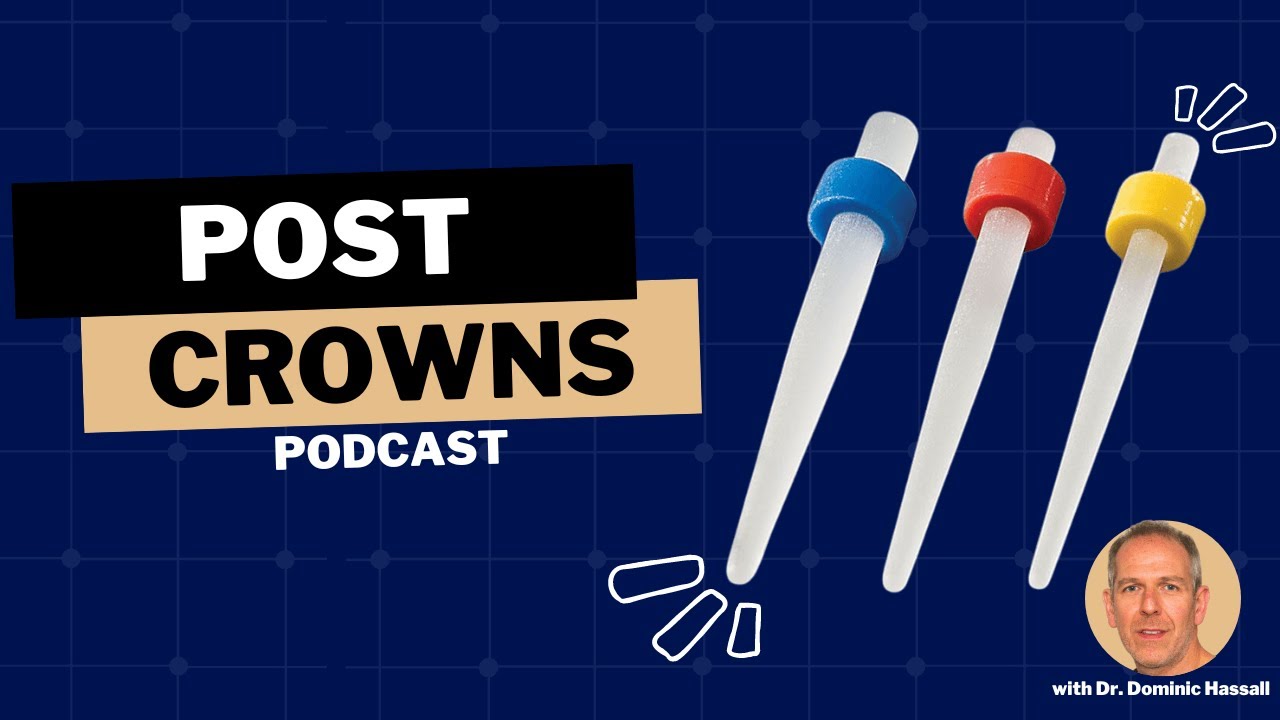 Штифтовые коронки &mdash; историческая техника или необходимое решение для проблемных зубов? - PDP154