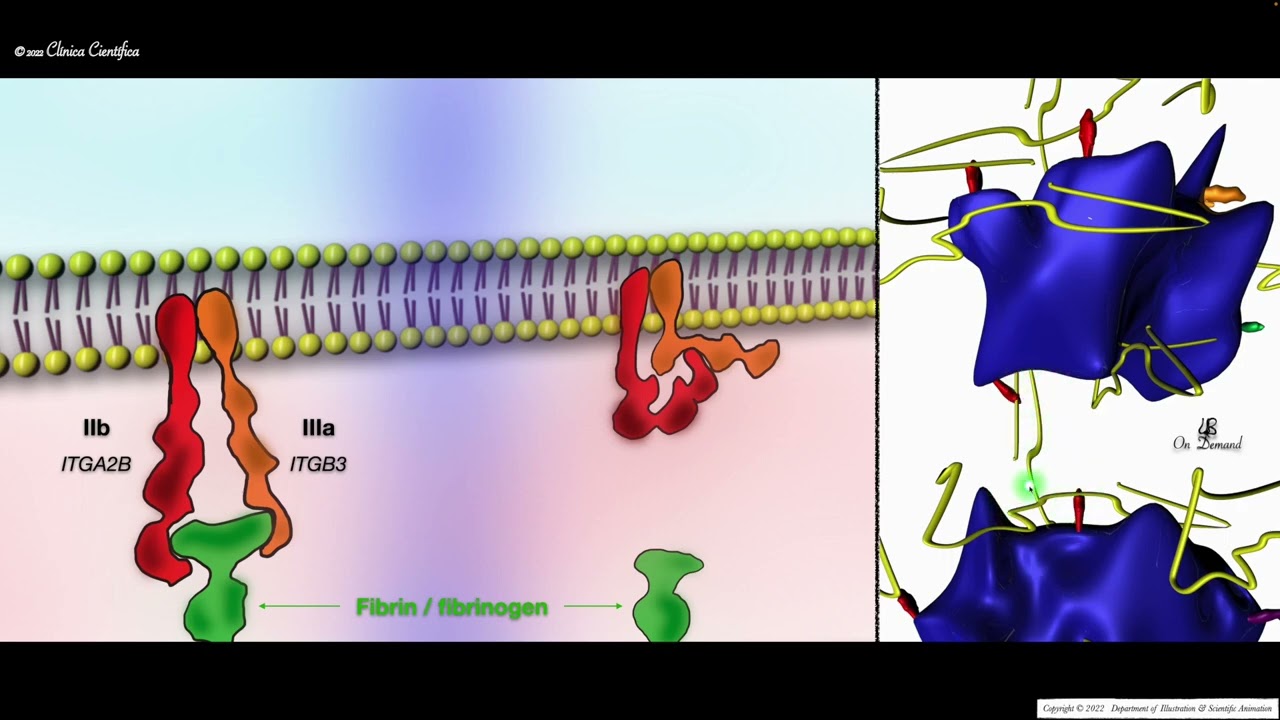 Glanzmann&acute;s thrombasthenia