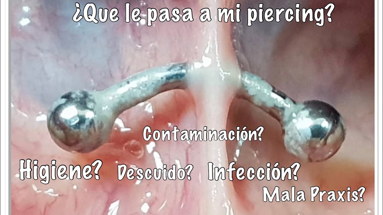 PIERCING INFECTADO 💉 PIERCING CONTAMINADO💉PIERCING MAL HECHO💉 &iquest;QUE LE PASA A MI PIERCING? 🤔💉😷