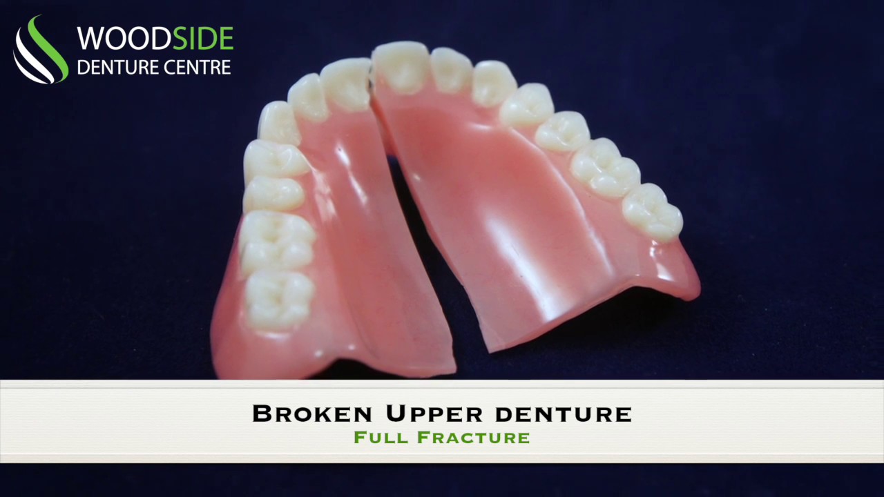 Denture Repair in  Airdrie, AB | Woodside Denture Centre