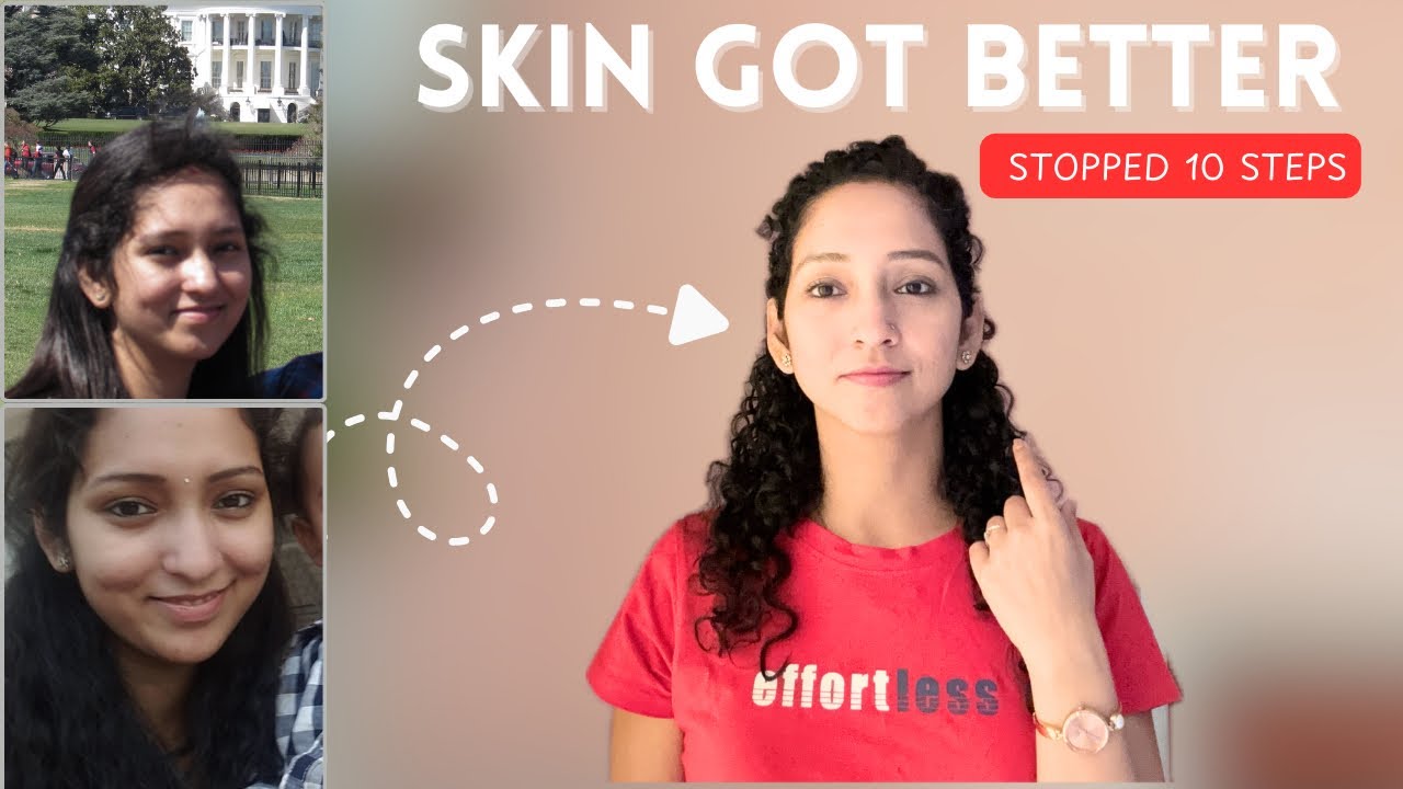 I Quit 10-Step Skincare… and My Skin Got Better