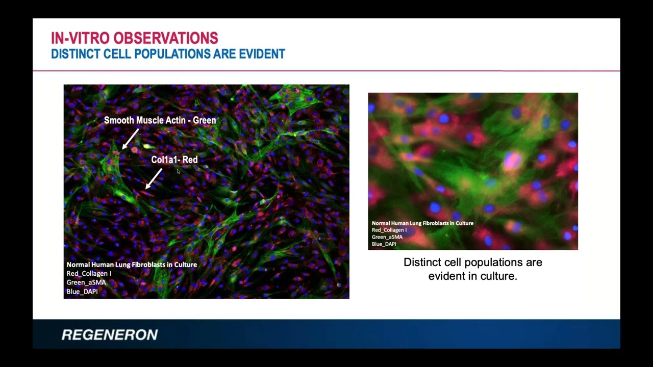AnaBios Webinar | Single Cell Sequencing to Identify Distinct Cell Populations from Fibrotic Tissue