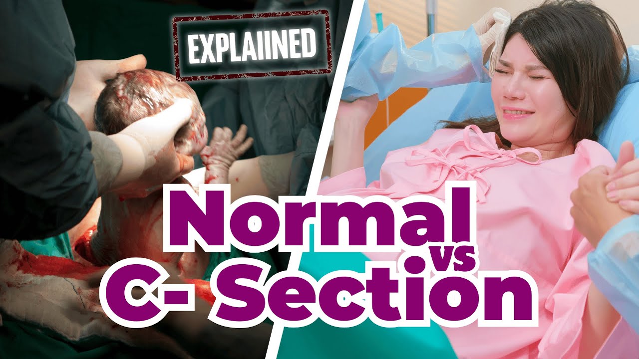 Normal Delivery vs C-Section (cesarean) Delivery | Explained