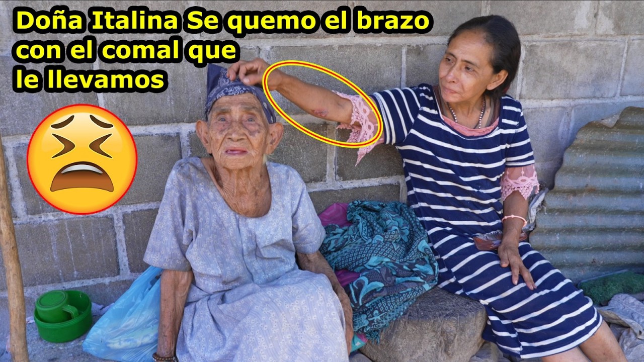Buena estrenada le dio al comal dice doña Italina, se quemó el brazo - Ediciones Mendoza