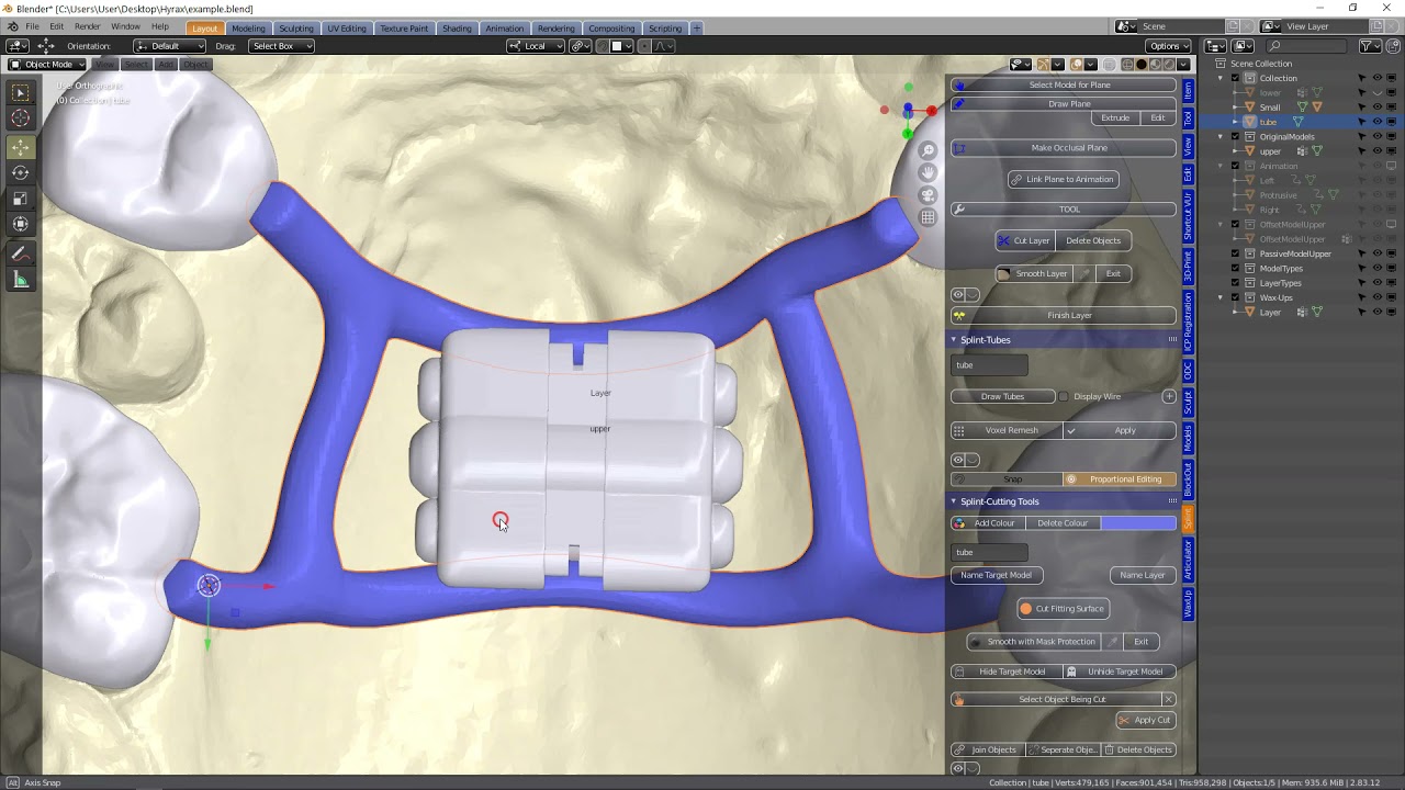 B4D Dental Modules- Ortho Expander