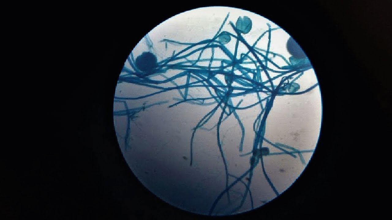 Rhizopus Slide Preparation #botany #CalcuttaUniversity #fortunecookie
