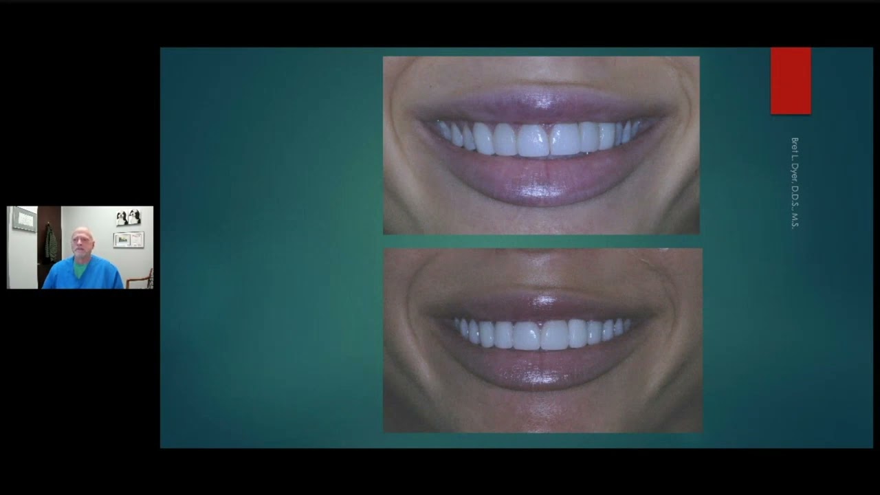 Learn All About Gummy Smiles From Dr. Dyer