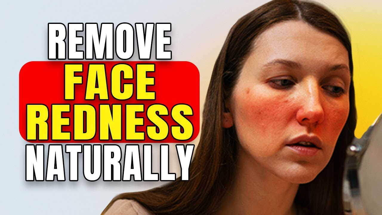 Best Rosacea Treatment | How to Get Rid of Redness on Face