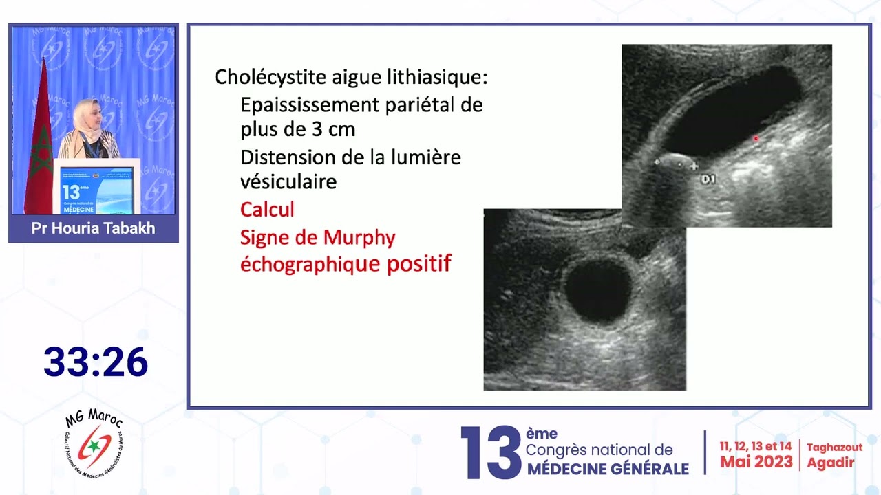 Cas cliniques d’échographie des  voies biliaires en médecine générale   Pr Houria tebakh