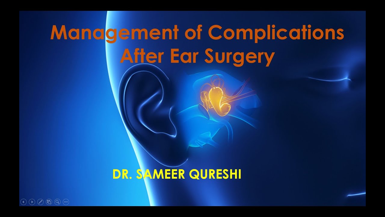 Management of Complications After Ear Surgery by Dr  Sameer Qureshi
