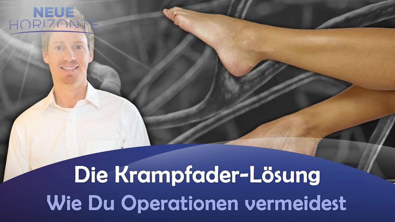 Die Krampfader-L&ouml;sung - Wie Du Operationen vermeidest - Constantin Mock