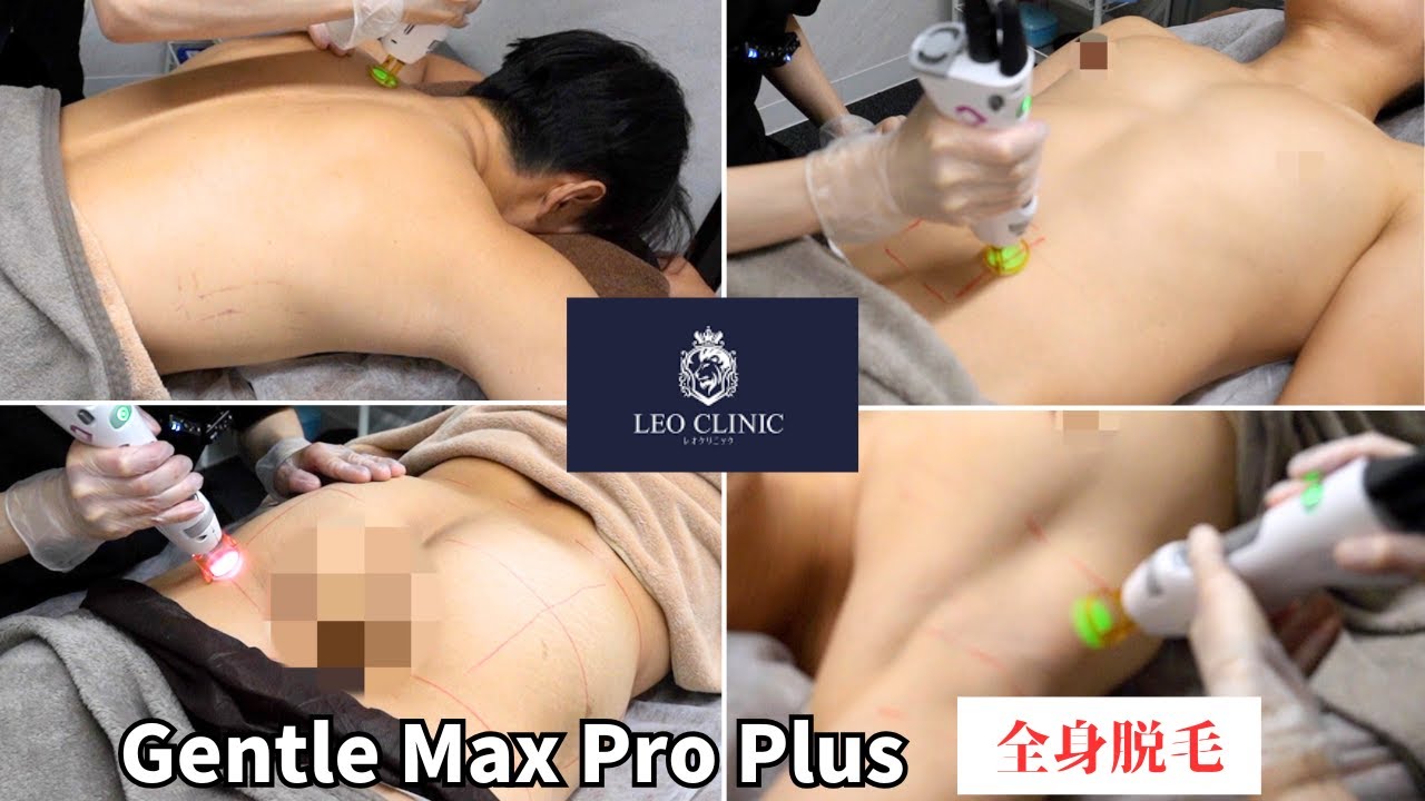 【レオクリニック恵比寿】最強のGentle Max Pro Plus全身脱毛できるクリニックがあった、、、