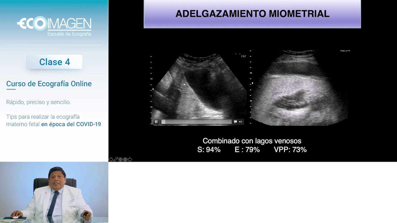 Clase 04 - Evaluar Placenta y Cordón Umbilical | Curso de Ecografía Online