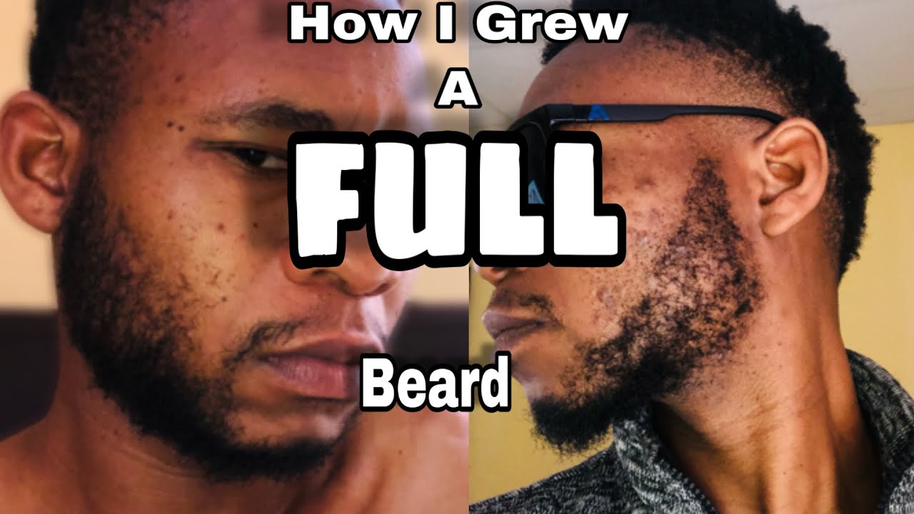 How to grow a full beard in two years? | minoxidil South African YouTuber