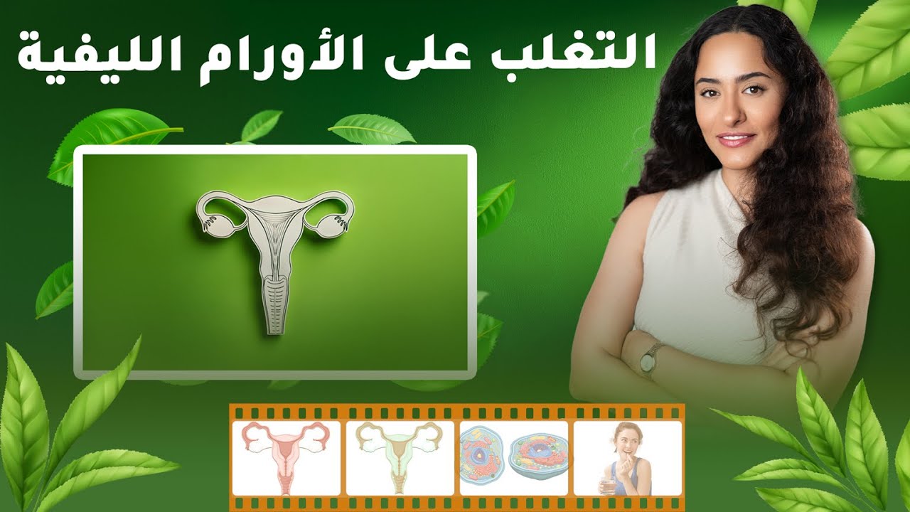 للتخلص من الأورام الليفية بطرق بسيطة ستدهشك
