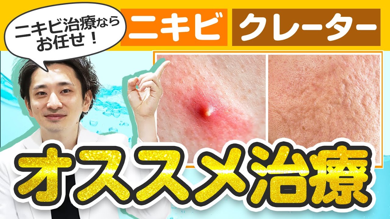 【 医師解説 】 ニキビ ・ クレーター をきれいにする方法【 品川美容外科 / 品川スキンクリニック 】