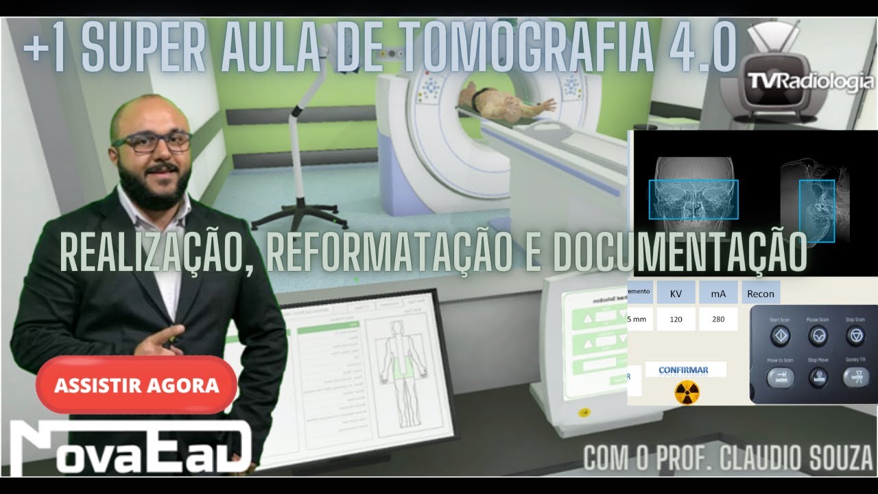 [TOMOGRAFIA 4.0 LIVE] - REALIZA&Ccedil;&Atilde;O, REFORMATA&Ccedil;&Atilde;O E DOCUMENTA&Ccedil;&Atilde;O DO EXAME DE MAST&Oacute;IDES