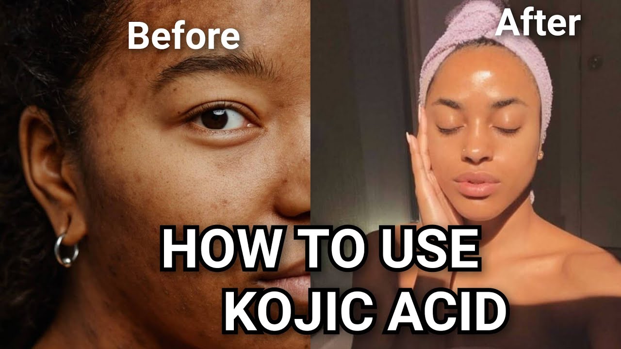 HOW TO USE KOJIC ACID SOAP * WATCH THIS BEFORE USING KOJIC ACID * Kojic acid for dark spots