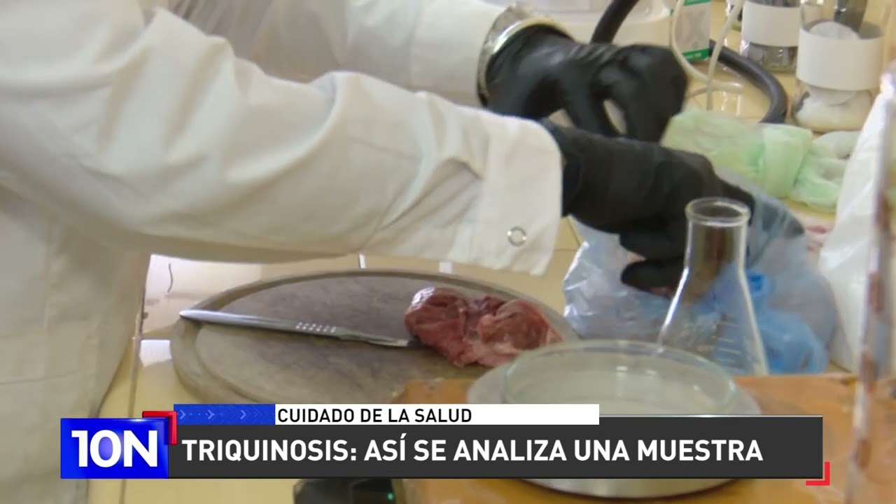 En 10N te mostramos como se realiza un análisis de triquinosis