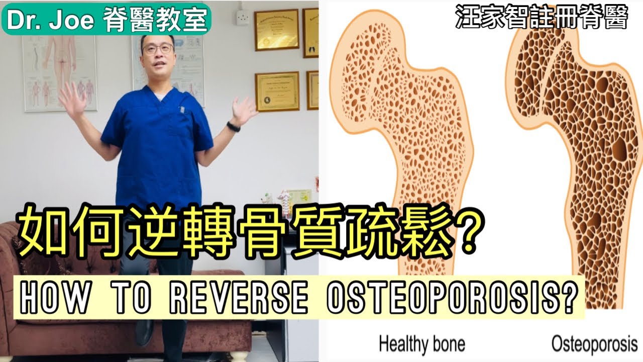 如何逆轉骨質疏鬆？ Dr Joe 教大家兩種方法: 運動及營養[Eng Subtitles] How to Reverse Osteoporosis in 2 Steps.