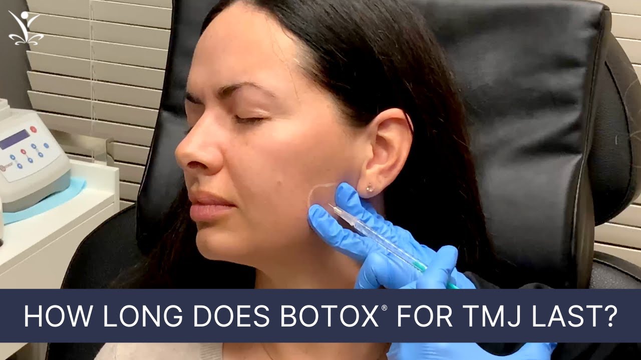 Botox for Masseters | Stop TMJ, Headaches and Teeth Grinding
