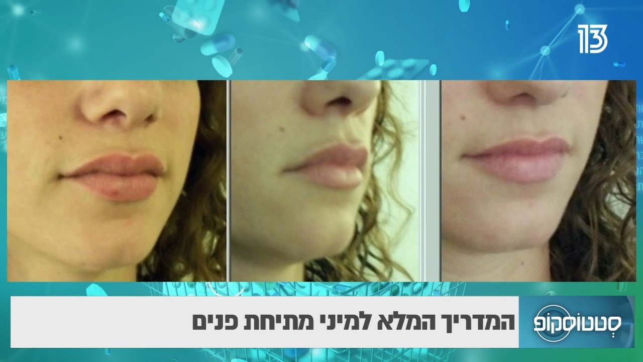 המדריך המלא למיני מתיחת פנים - ד