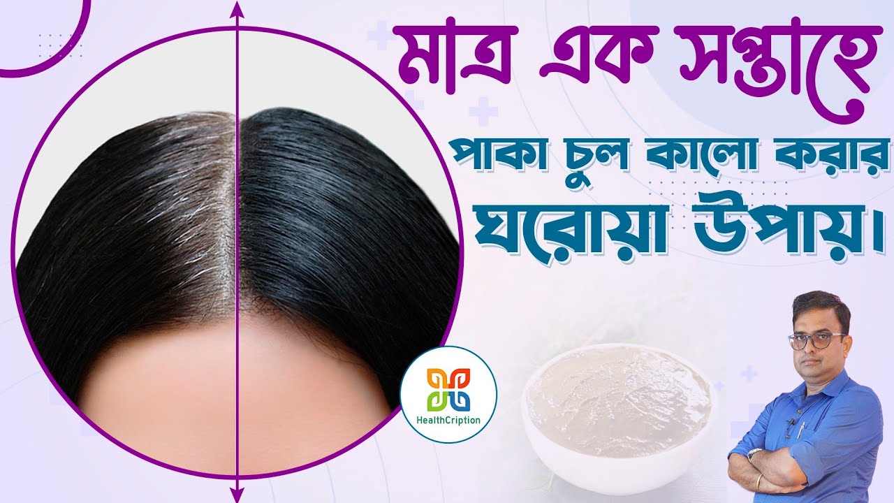 How to cure Grey Hair/white hair Naturally.White hair solutions .সাদা চুল কালো করার  ঘরোয়া সমাধান ।