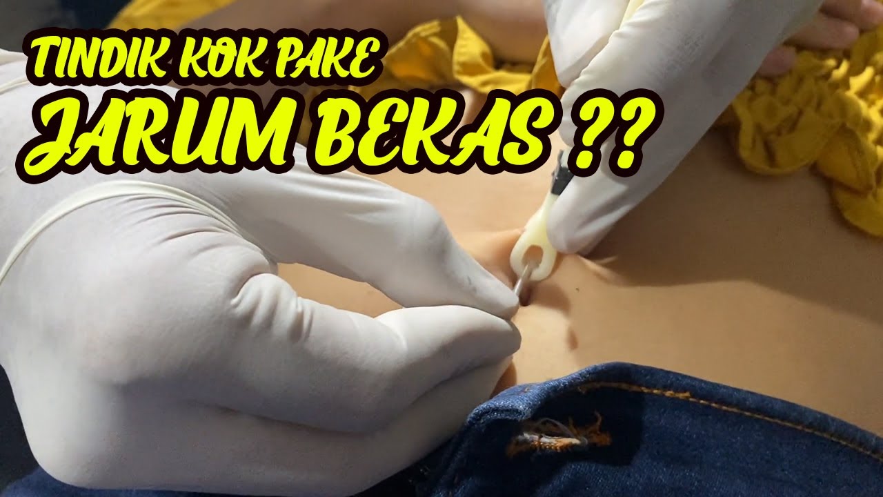 TINDIK PUSAR KE 2x ‼️ SETELAH TINDIK PUSAR PERTAMA SOBEK || BELLY PIERCING