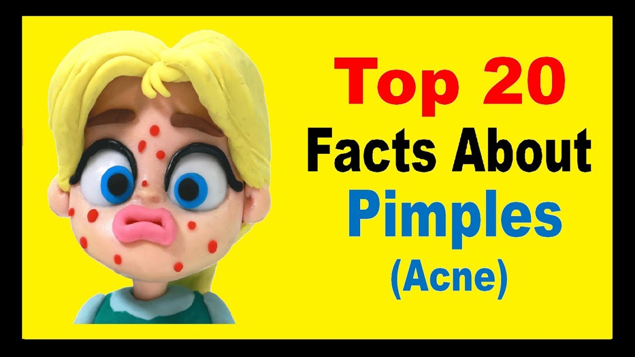 Pimples  (Acne) - Facts