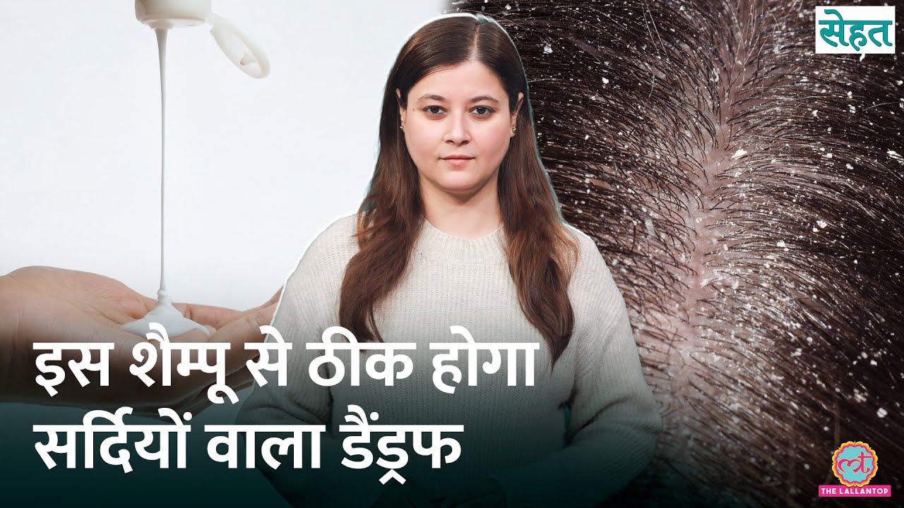 Winter में Dandruff, Dry Scalp से परेशान? डॉक्टर से जानिए इलाज | Sehat Ep. 1269