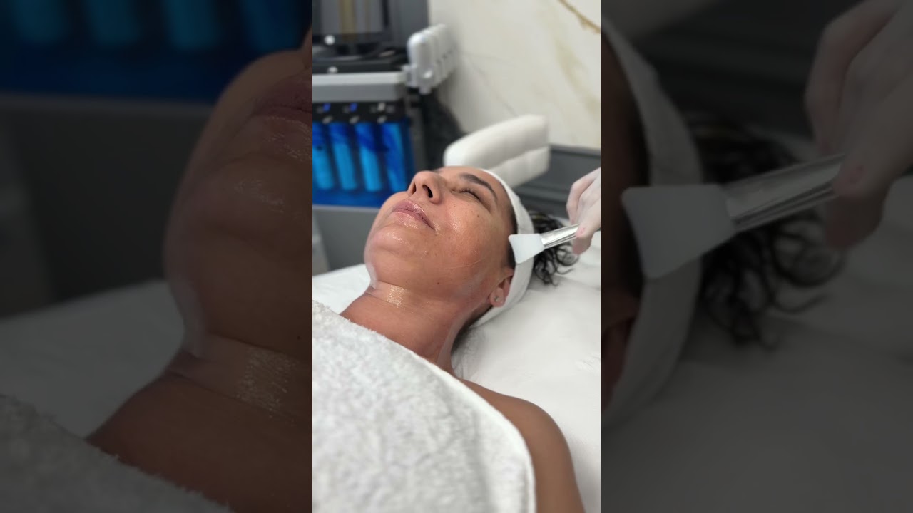 A spus cineva lifting facial? #liftingfacial #vitaminac #fermitate #riduri #tratamentefaciale