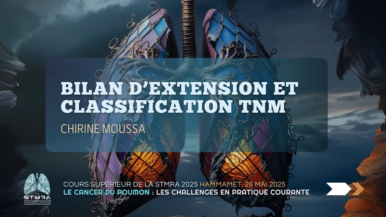 Bilan d’extension et classification TNM. Chirine Moussa