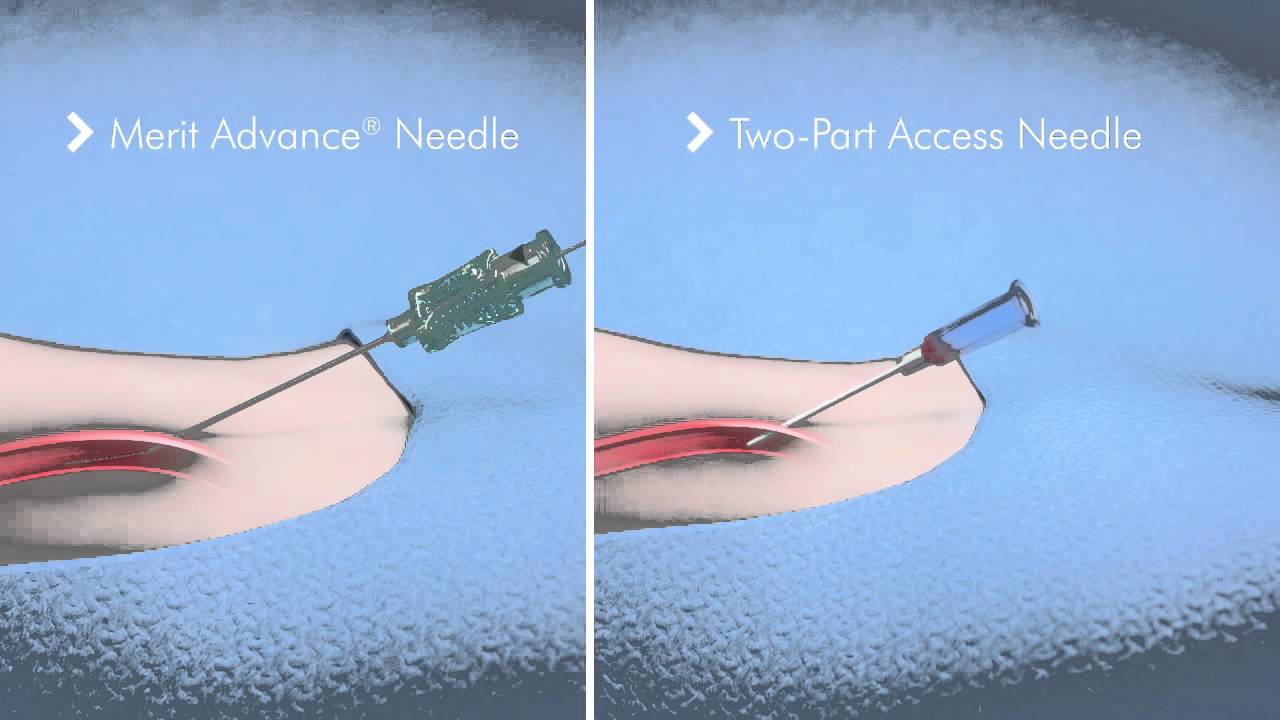 PreludeEASE™ Hydrophilic Sheath Introducer