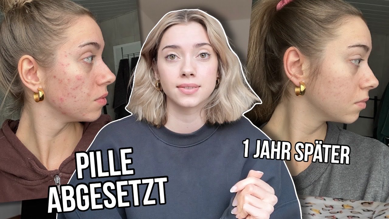 Ich habe die Pille abgesetzt und das ist passiert.. (1 Jahr später) - VLOG