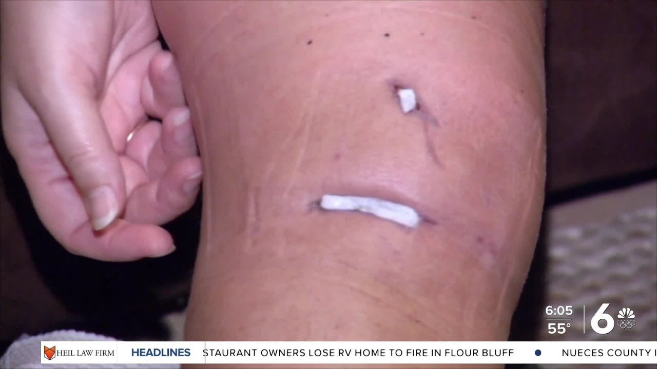Health officials warns, Vibrio risk grows as water's warm