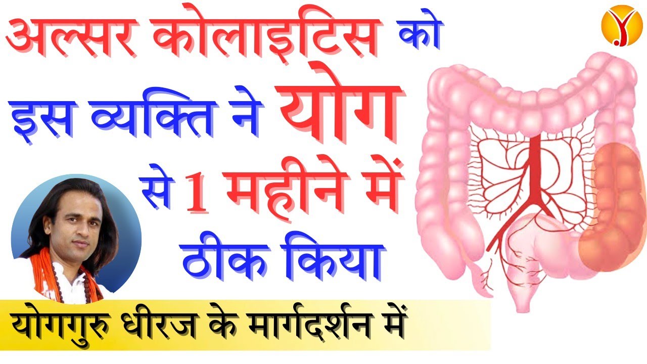 Ulcerative Colitis का Yoga से ईलाज | आंत, पेट उदर रोग, Bowel Disease की Therapy | Yog Guru Dheeraj