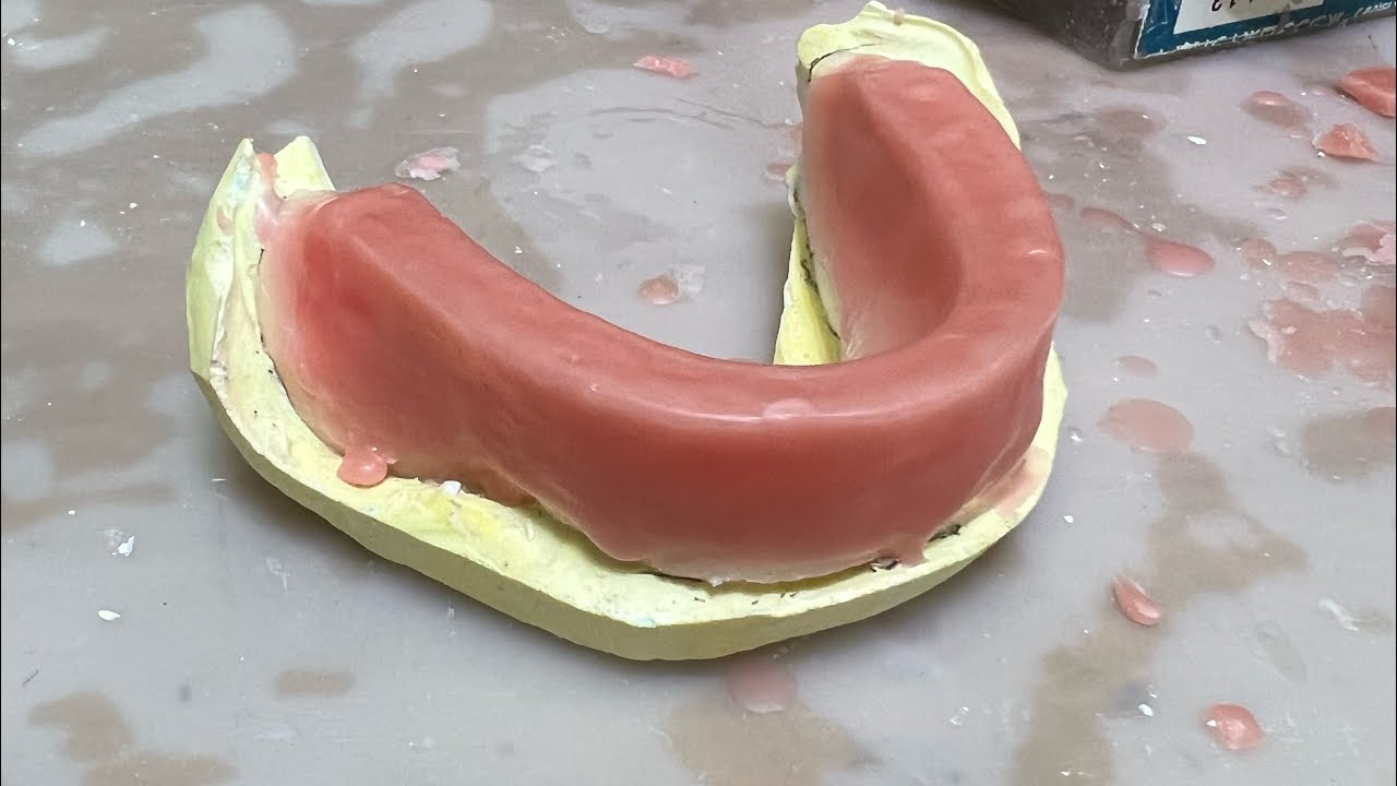 下顎ローテイ
