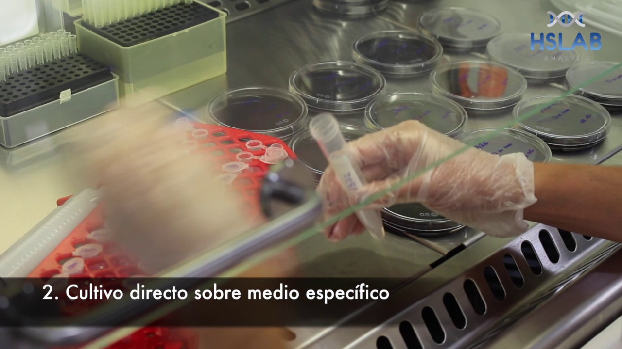HS LAB Detección y recuento de Legionella Pneumophilla en agua (Basado en ISO 11731)