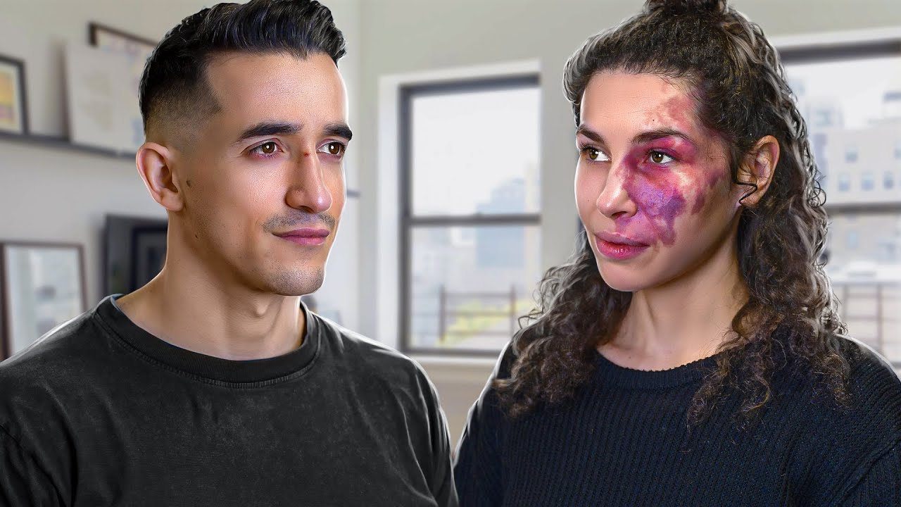 Vivre avec une tache sur le visage (angiome)