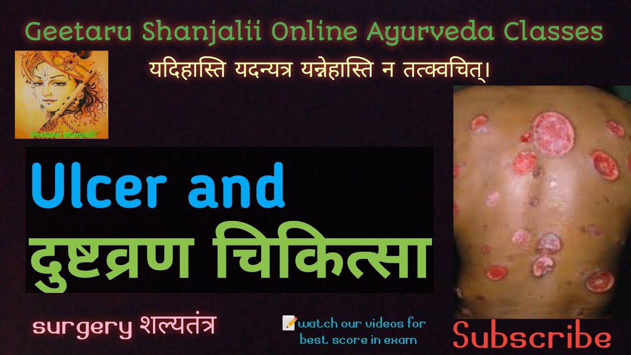Ulcer and dhusht vran दुष्टव्रण चिकित्सा By Geetaru