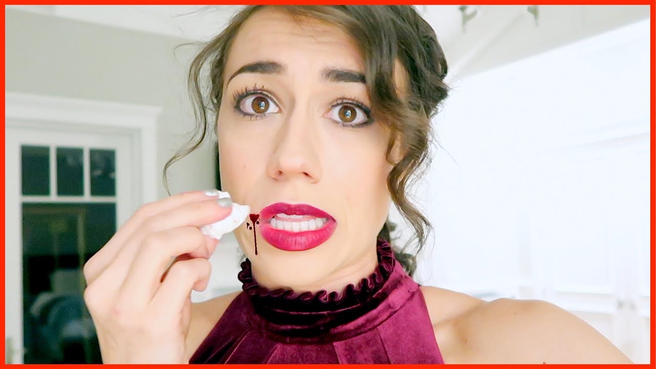 MY FACE WONT STOP BLEEDING!