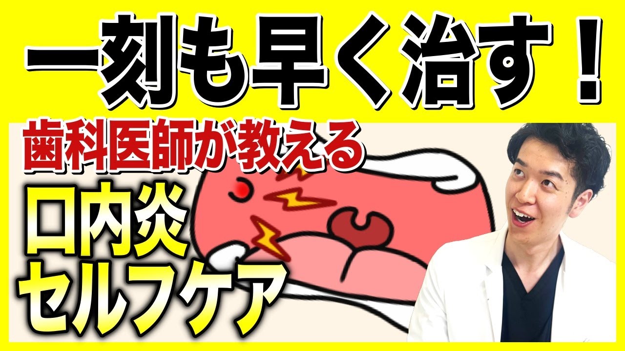 【歯科医師もやっている】つらい口内炎、一刻も早く治す方法７選！