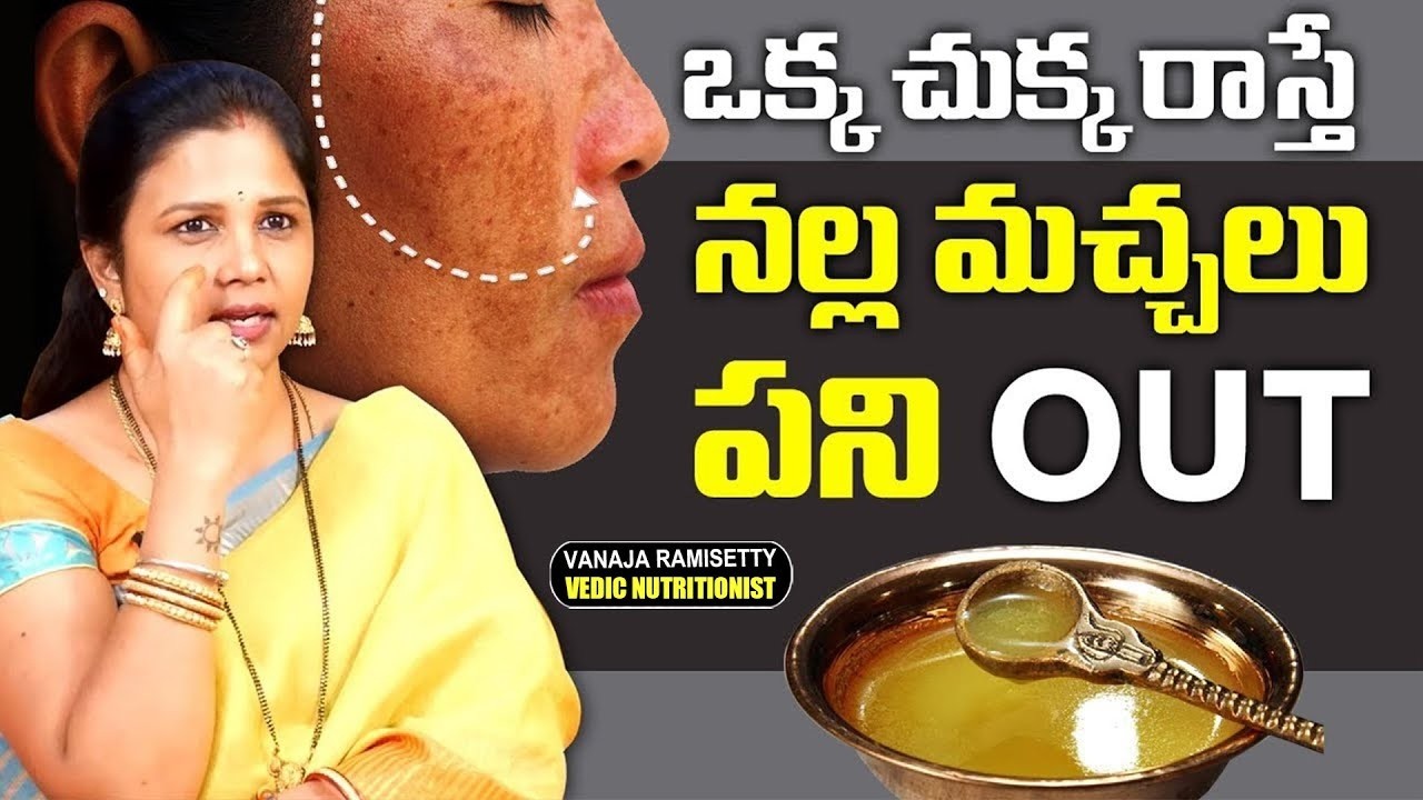 ముఖం పై పిగ్మెంటేషన్ మంగు మచ్చలు ముడతలు మొత్తం పోతాయి | Vanaja Ramisetty Winter Skin Care Tips