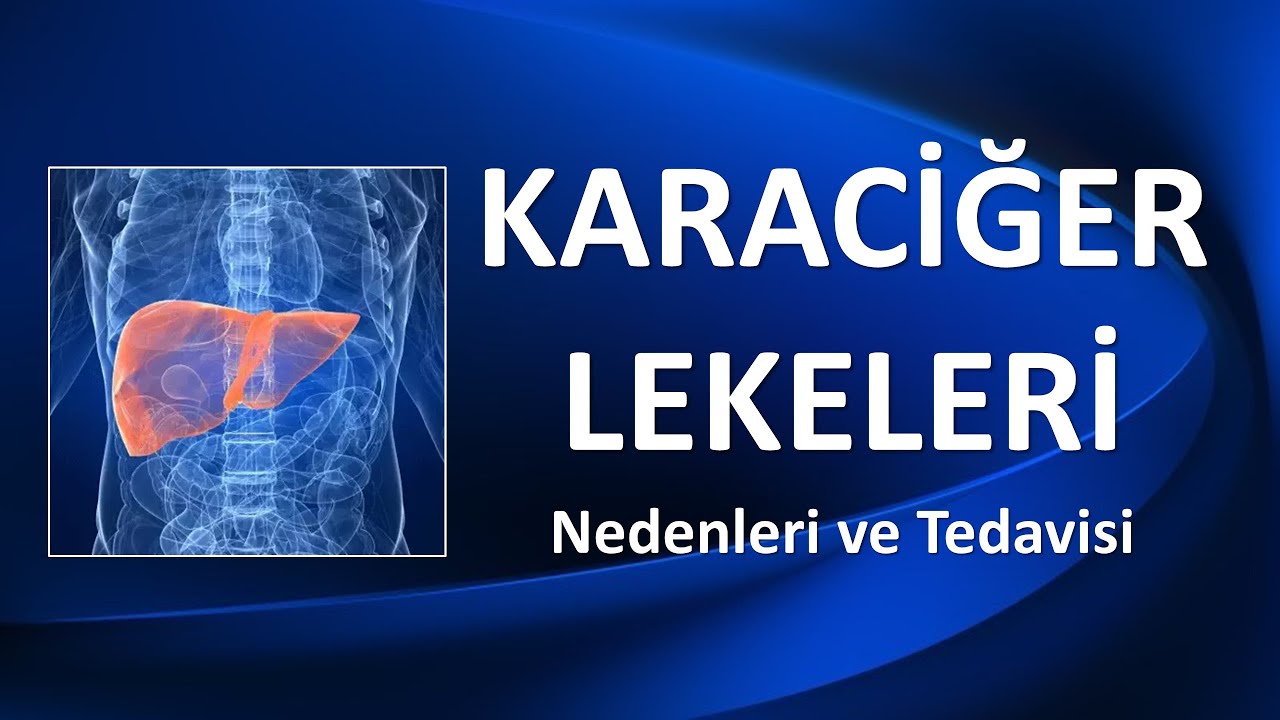 KARACİĞER LEKELERİ Nedenleri ve Tedavisi
