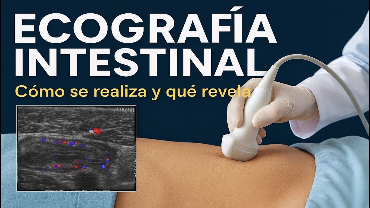 Ecografía Intestinal: Cómo se Realiza y Qué Revela | Ultrasonido Abdominal Explicado Paso a Paso
