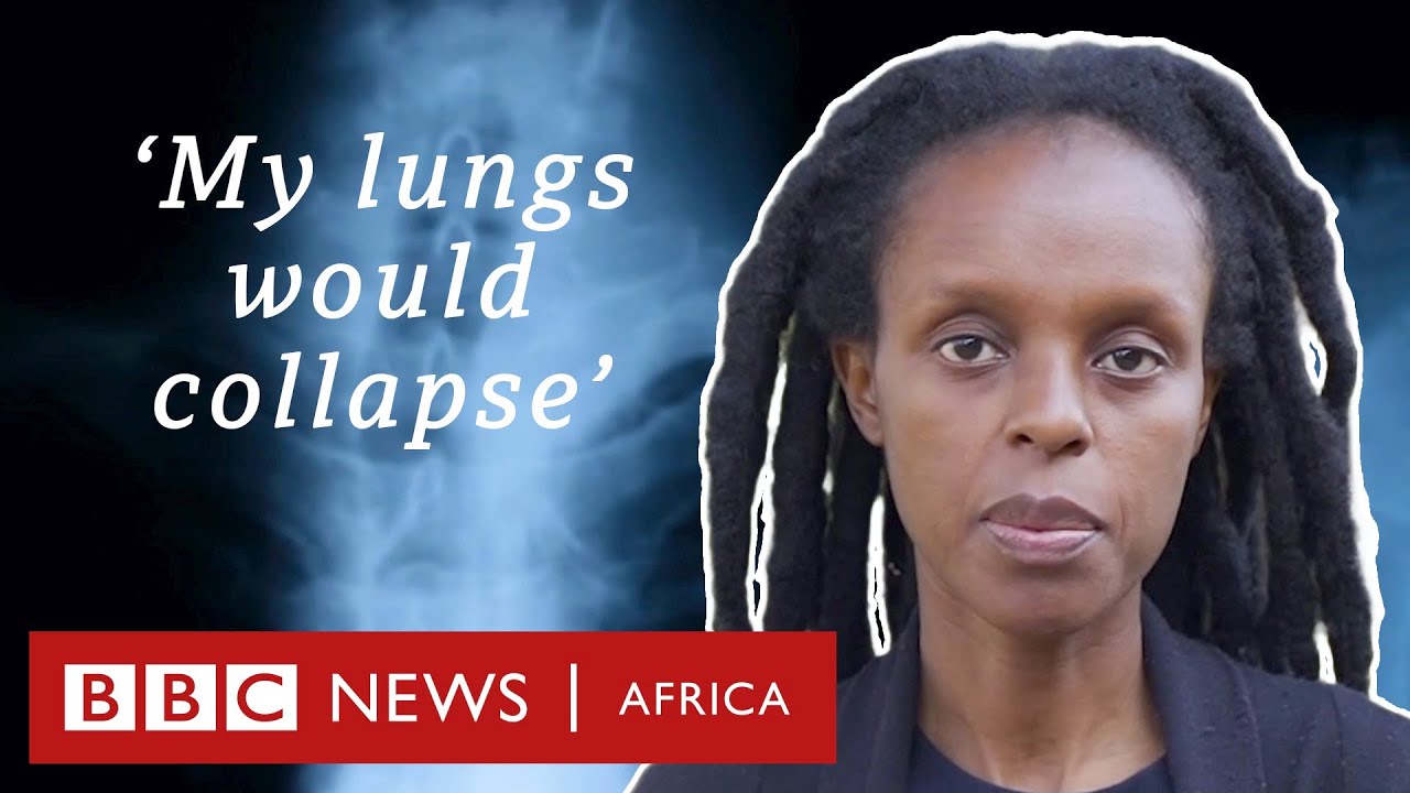 Endometriosis: 'Doctors would tell me it's in my head' - BBC Africa