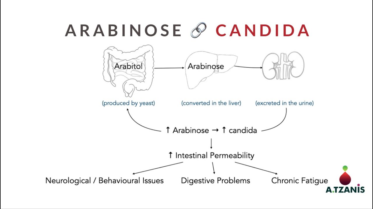 Arabinose : Candida Overgrowth (OAT Test)
